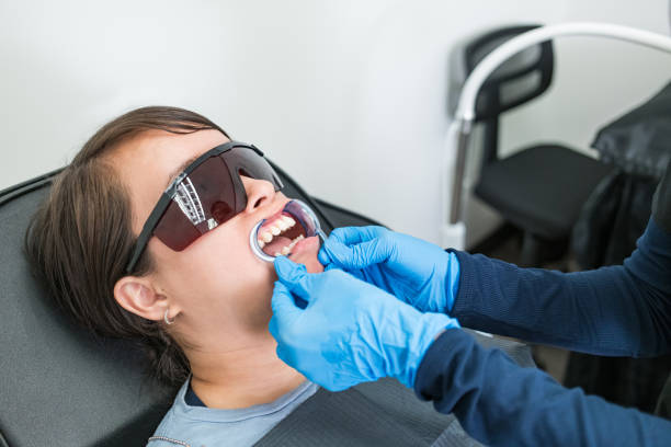 Teeth Whitening in GA