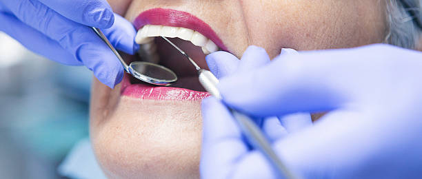 Best Knocked-Out Tooth Emergency  in Decatur, GA